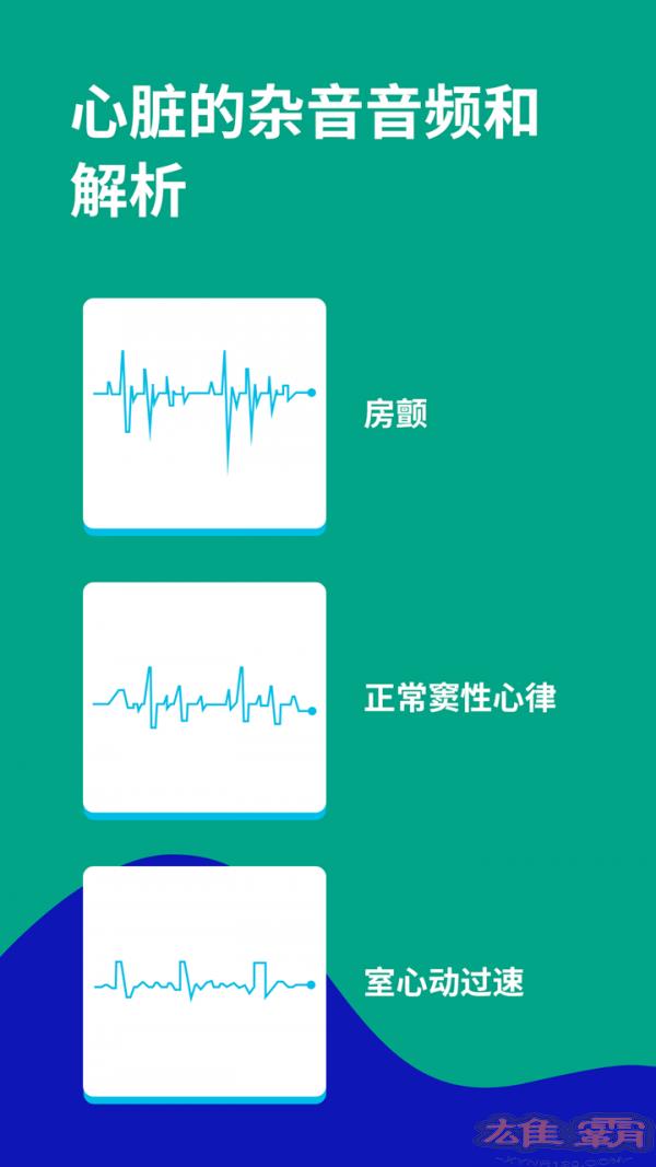 心电图ECG